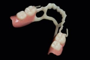 1. Foto BioDentaplast-MOG 1. Foto BioDentaplast-MOG