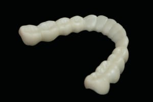2. Foto BioDentaplast Snap-on Schiene 2. Foto BioDentaplast Snap-on Schiene