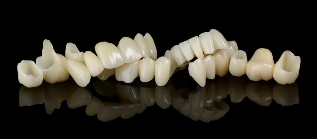 Provisorien Provisorien