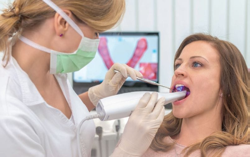 Die richtige Abformung mittels Intraoralscanner